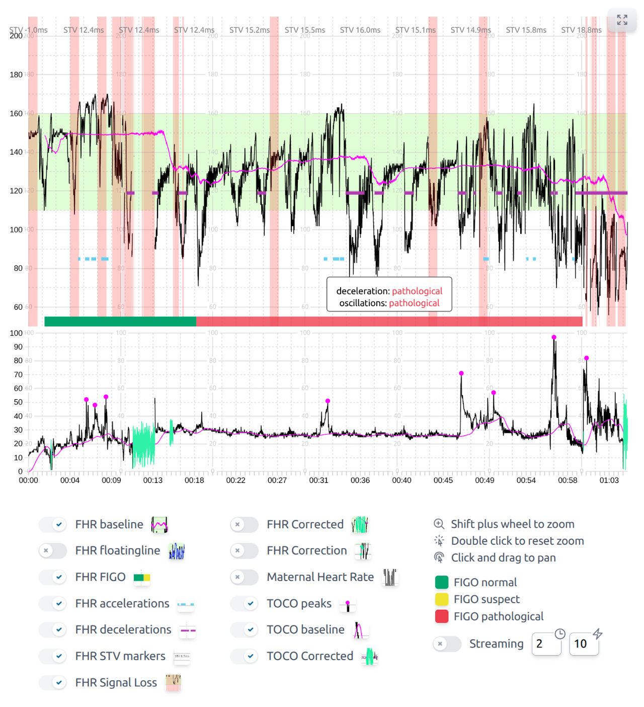 Trium CTG Cloud features screenshot